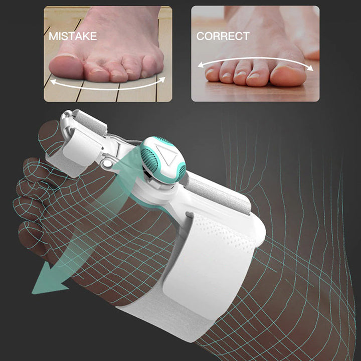 Upgraded Toe Bunion Corrector - 3D Knob Toes Corrector - FOFOPO