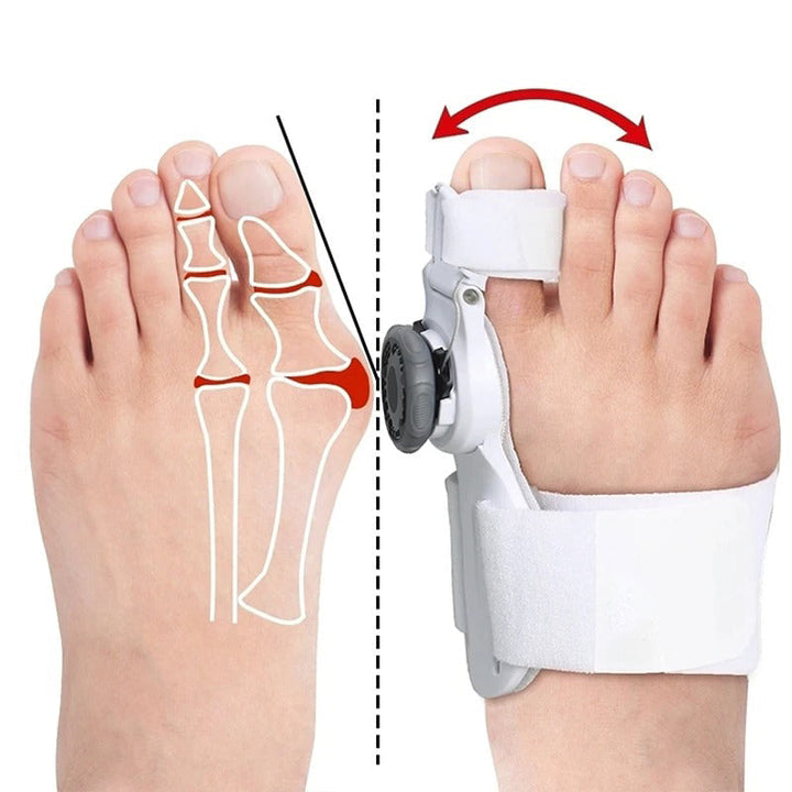 Upgraded Toe Bunion Corrector - 3D Knob Toes Corrector - FOFOPO