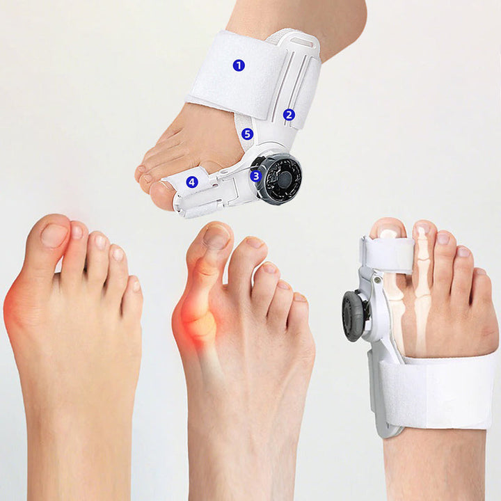 Upgraded Toe Bunion Corrector - 3D Knob Toes Corrector - FOFOPO