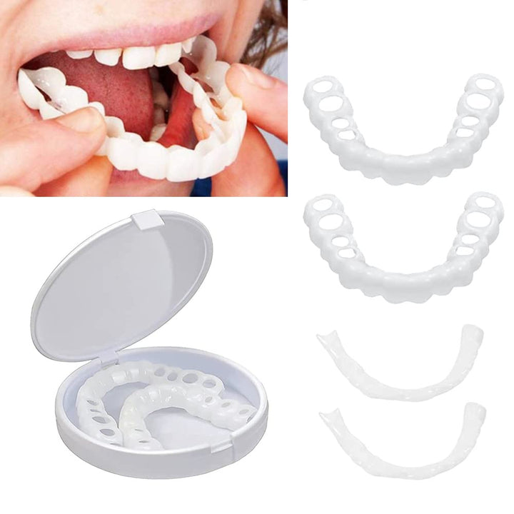 Snap on Smile Veneers - FOFOPO