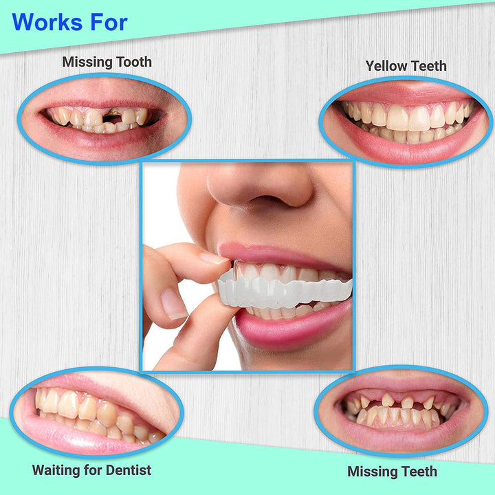 Snap on Smile Veneers - FOFOPO