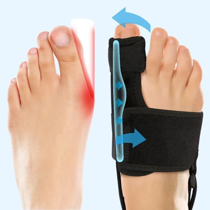 Oreglory – Bunion Brace - FOFOPO