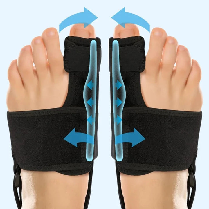 Oreglory – Bunion Brace - FOFOPO