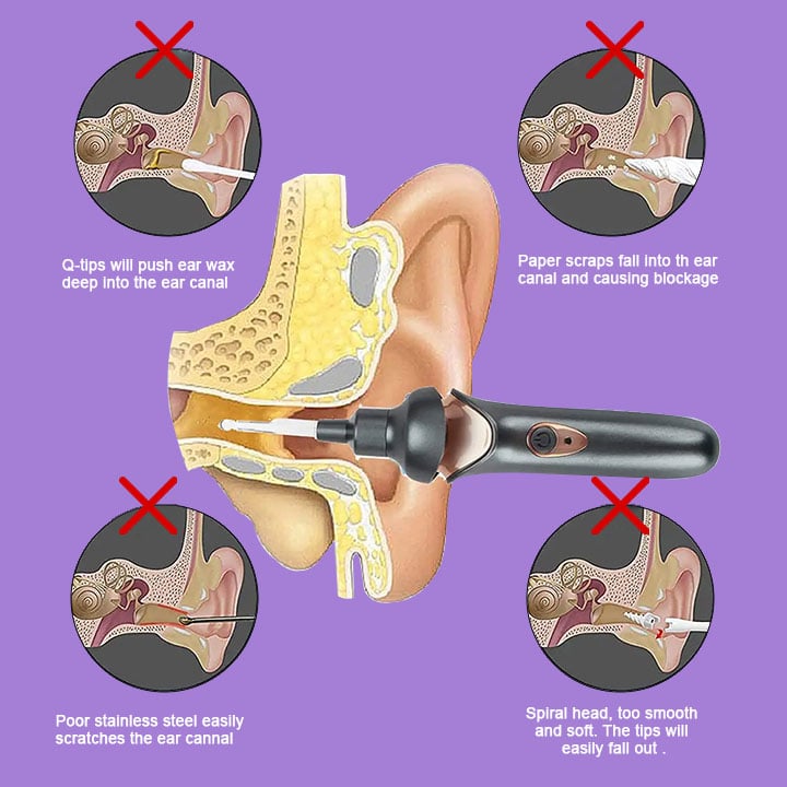 Painless ear cleaning for the whole family - FOFOPO