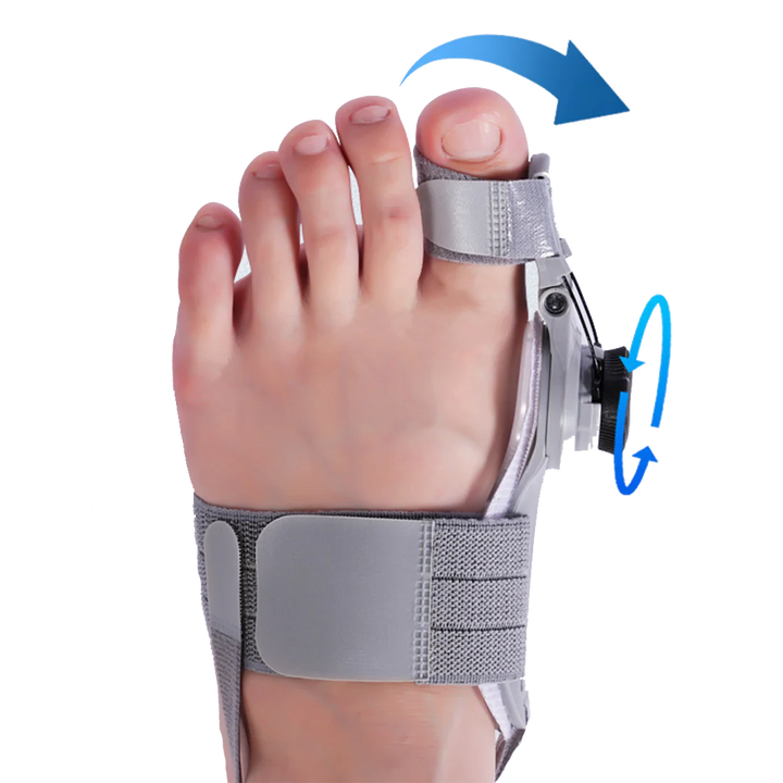 Bunion Fix – Natural At-Home Bunion Relief - FOFOPO