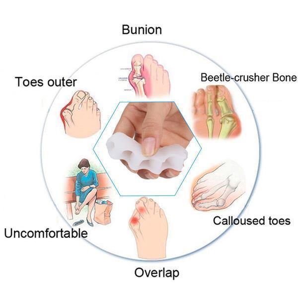 Orthopedic Toe Corrector - Toe Separator - FOFOPO