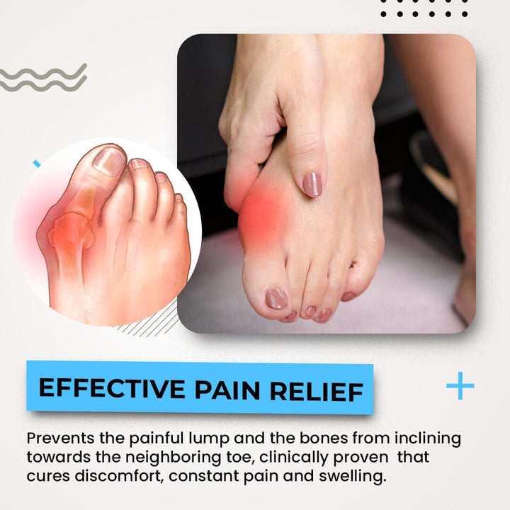 3D Bunion Splint Corrector - FOFOPO
