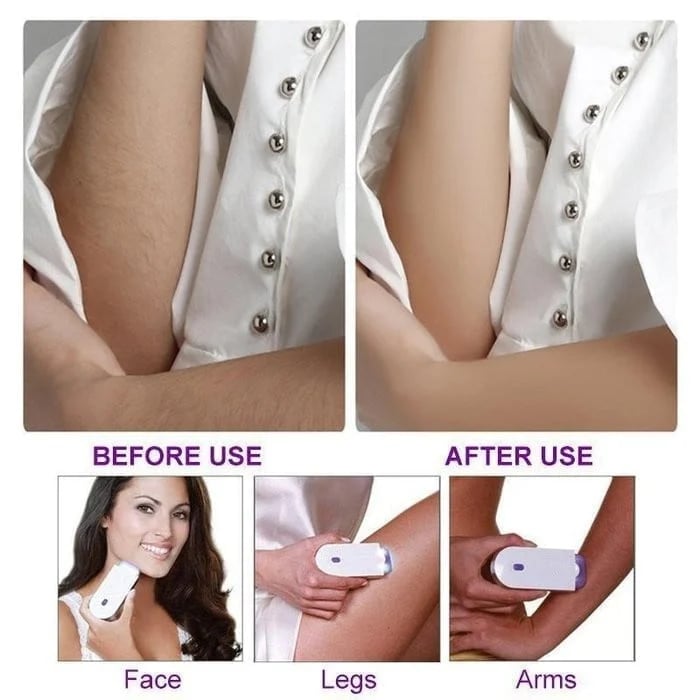 Painless Hair Removal Kit - FOFOPO